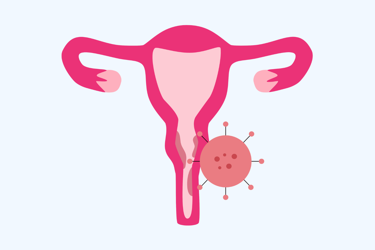 OBGYN ONKOLOGI GINEKOLOGI
